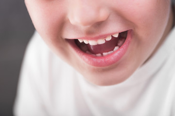 Closeup photo of boy mouth smiling