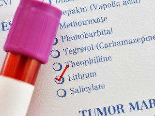 Test tube with blood sample for lithium test
