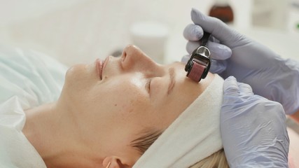 Close-up portrait of woman having beauty skin treatment. Therapist preparing skin with derma roller.