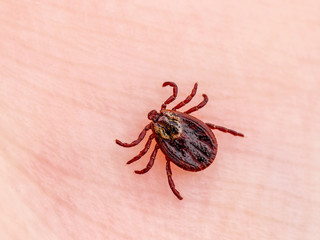 Encephalitis Virus or Lyme Borreliosis Disease Infectious Dermacentor Tick Arachnid Parasite Insect on Skin Macro