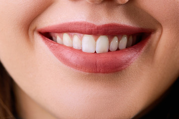 Closeup Woman smile. Teeth whitening. Dental care. Restoration concept. Lips
