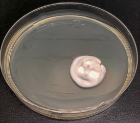 contaminated fungi on potato dextrose agar