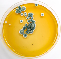 Penicillium sp. on Sabouraud's dextrose agar (SDA) incubated at 25 celsius 5 day