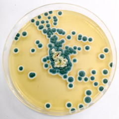 Penicillium sp. on Sabouraud's dextrose agar (SDA) incubated at 25 celsius 5 day