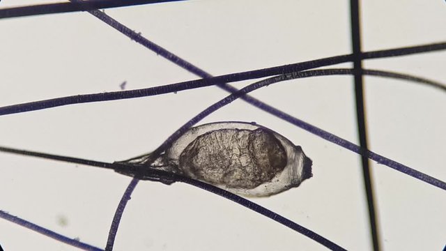 Lice egg attached to the hair, video taken with a high magnification microscope.	