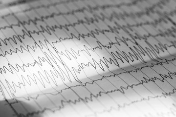 Electroencephalogram result on paper closeup, brain activity test