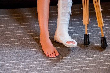 girl with a broken leg .close-up of feet, one with a plaster bandage. foot splint for treatment of...