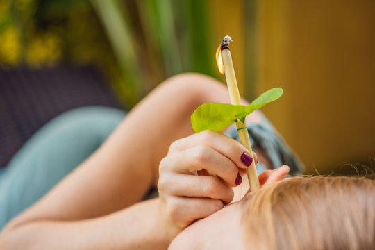 Ear candling being carried out on an attractive caucasian woman in a spa
