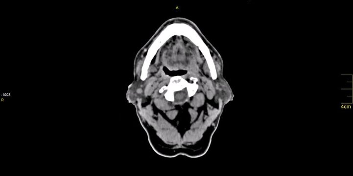 brain tomography, medical imaging methods health examinations