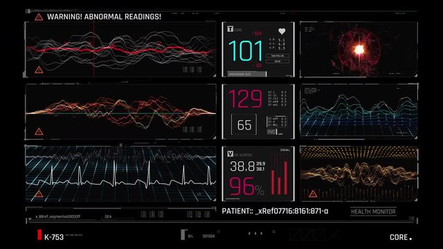 Hospital care monitor, patient's readings getting worse, unstable condition. Medicine, health care, critical care
