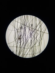 lice invasion, photo of lice eggs on hair under high magnification