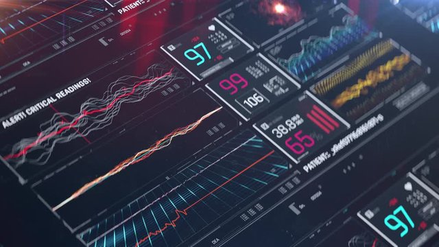 No pulse and revival, heart starts beating, resuscitation, ICU health monitor . Medicine, health care, critical care