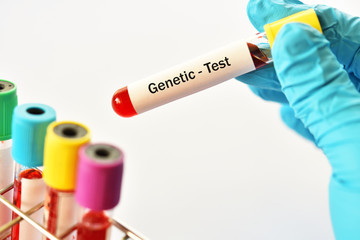 Test tube with blood sample for genetic testing