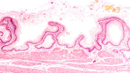 Fototapeta na wymiar Cross section of a human gallbladder, from a patient with gallstones, showing simple columnar epithelium.