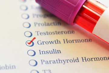 Blood sample tube with laboratory requisition form for growth hormone test