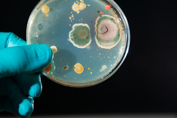 petri dish with microbe colony in doctor hand