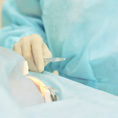 Ophthalmology laser microscope operation. Doctor in clinic. Patient eye treatment. Myopia and...