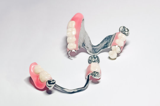 a set of removable clasp prostheses with supporting metal-ceramic and metal crowns on the upper and lower jaws on an isolated background