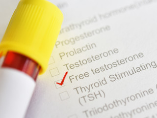 Blood sample tube for free testosterone hormone test