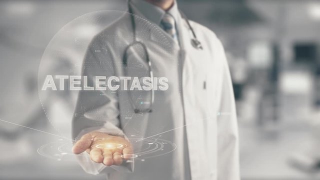 Doctor holding in hand Atelectasis