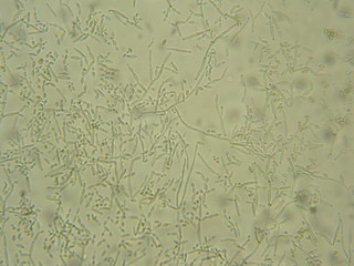 Cladosporium