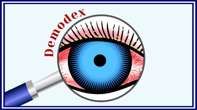 Demodex. Parasitic eye disease. Animation 