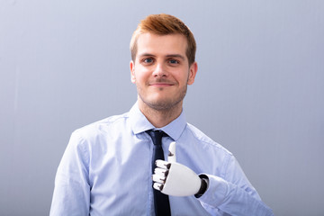 Businessperson With Prosthetic Limb Showing Thumb Up