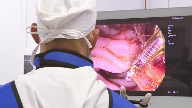 Doctors use medical instruments and video cameras to perform abdominal surgery .