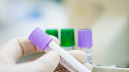 EDTA purple test tube compleate blood count test and lithium heparin green test tube for blood...