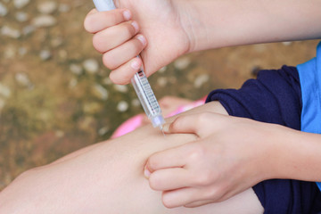 An Asian girl using insulin pen.Self insulin injection.Diabetes in children.