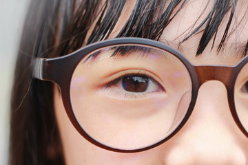 An Asian girl is wearing glasses. Short sight in an  children girl.