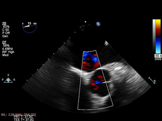 Screen of echocardiography (ultrasound) machine.