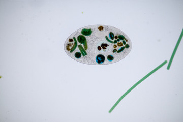 Frontonia sp. is a genus of free-living unicellular ciliate protists under the microscope.