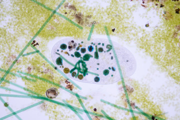 Frontonia sp. is a genus of free-living unicellular ciliate protists under the microscope.