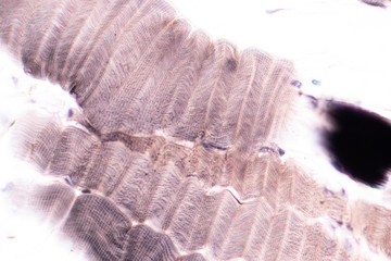 Education anatomy and Histological sample Striated muscle Tissue under the microscope.