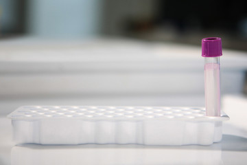 Empty test tube in a laboratory. The concept of laboratory work.
