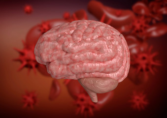 Meningitis is an inflammation of the meninges, which are the membranes that surround the brain