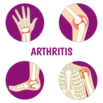 Vector Illustration on the theme World Arthritis Day