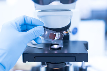 Selective focus technician hand holding microscope glass slide for scientist diagnosis and blurry microscope lens at cytology and pathology department in the hospital.