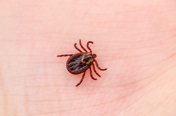 Encephalitis Virus or Lyme Borreliosis Disease Infectious Dermacentor Tick Arachnid Parasite Insect on Skin Macro