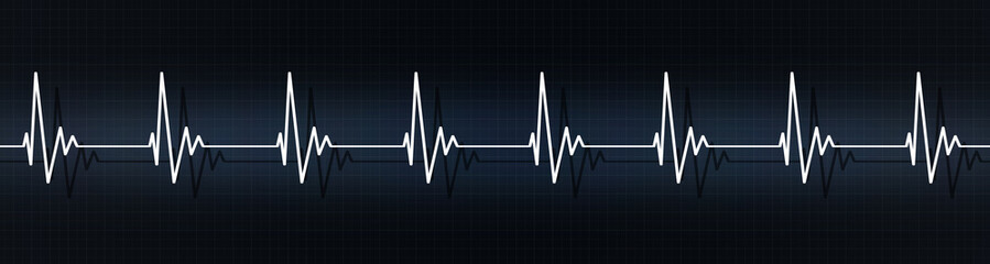 heart beats on ecg