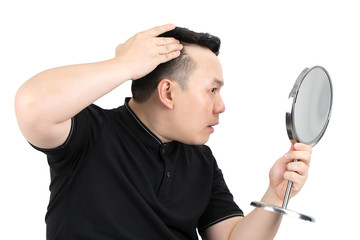 Portrait of serious young Asian bald man with alopecia, checking hairline while looking at the mirror isolated on white background. Hair loss, hair transplant concept.