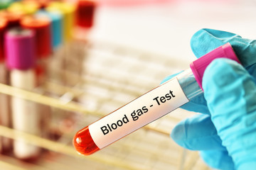 Blood sample tube for blood gas test