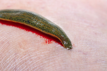 Aquatic Leech sucking blood on skin,Leeches were used in medicine from ancient