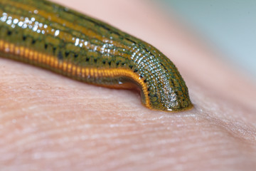 Aquatic Leech sucking blood on skin,Leeches were used in medicine from ancient