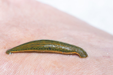 Aquatic Leech sucking blood on skin,Leeches were used in medicine from ancient