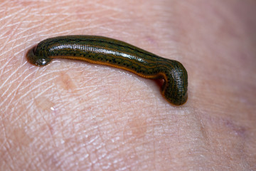Aquatic Leech sucking blood on skin,Leeches were used in medicine from ancient