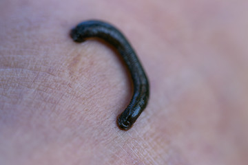 Aquatic Leech sucking blood on skin,Leeches were used in medicine from ancient