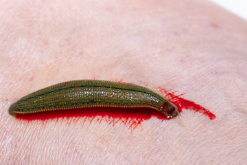 Aquatic Leech sucking blood on skin,Leeches were used in medicine from ancient