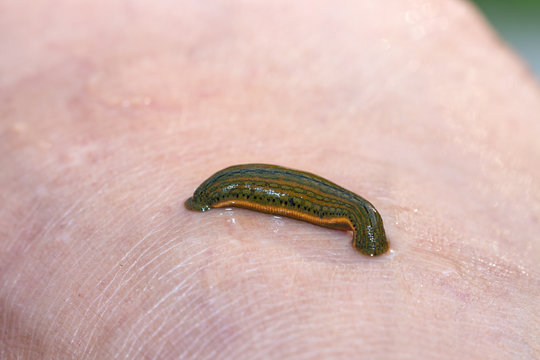 Aquatic Leech sucking blood on skin,Leeches were used in medicine from ancient